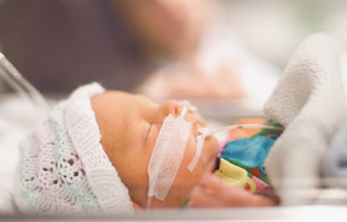 Premature newborn receives ventilator support