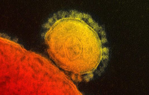 This file photo provided by the National Institute for Allergy and Infectious Diseases shows a colorized transmission of the MERS coronavirus that emerged in 2012. (Photo11: NIAID via The Canadian Press/AP)