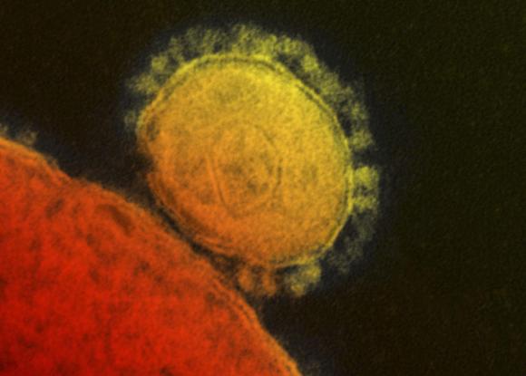 First case of MERS reported in Lebanon - health ministry