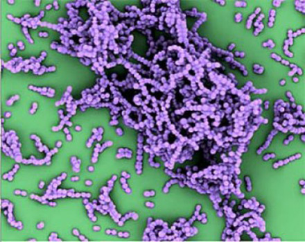 This is an electron micrograph, in false color, of group A Streptococcus bacteria. Credit: UC San Diego School of Medicine