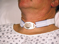 AirwayMgmt_DaleMed_TrachTube-200