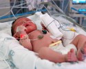 http://www.dreamstime.com/stock-photo-infant-nicu-image1483660