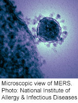 MERS virus doesn't seem to spread easily, study finds