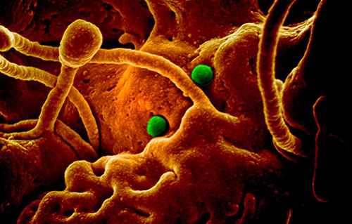 These are MERS coronavirus particles (green) on camel epithelial cells. Credit: NIAID in collaboration with Colorado State University.