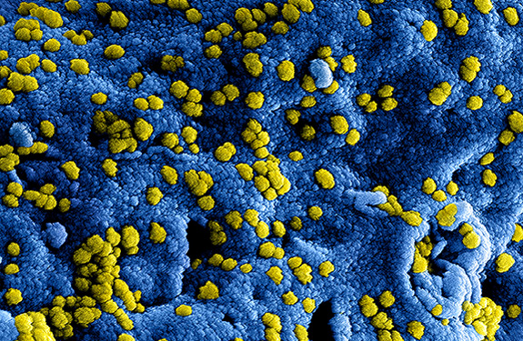 Colorized scanning electron micrograph of Middle Eastern Respiratory Syndrome virus particles attached to the surface of an infected VERO E6 cell. Credit NIAID